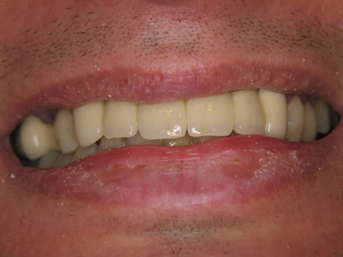Brug in de mond - tandartspraktijk in je element